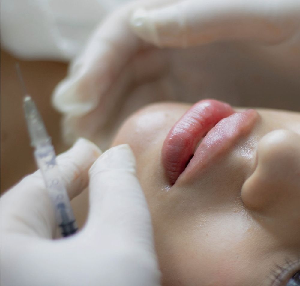 Close-up of a lip treatment performed by Grace & Elegant Wellness